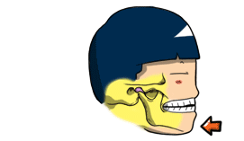 턱관절02.gif