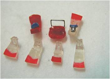 Lingual Attachments.jpg