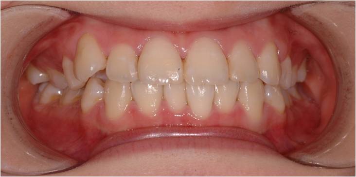 정면-장치가 전혀 보이지 않음.jpg