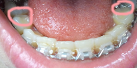 2011-06-17 16.20.37.jpg