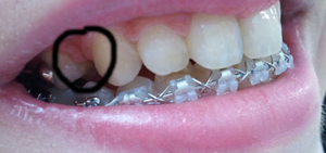 2011-06-17 16.21.28.jpg