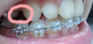 2011-06-17 16.19.59.jpg