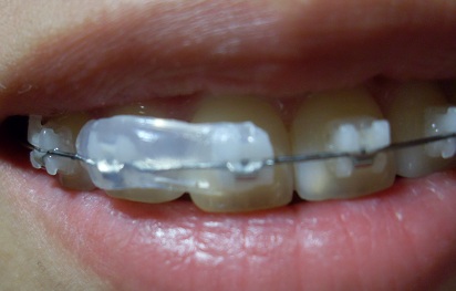 오라픽스 포스팅 사진 (3).JPG