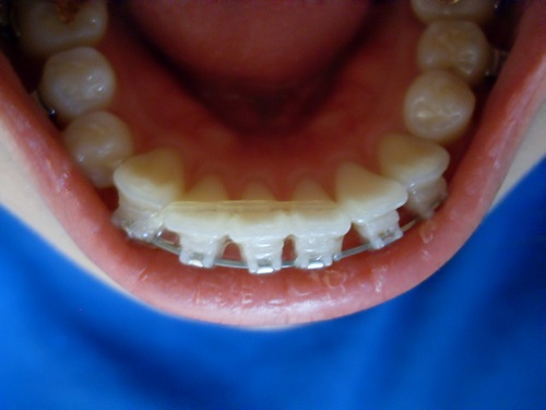 오라픽스 포스팅 사진 (6).JPG