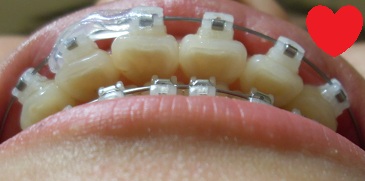 오라픽스 포스팅 사진 (5).JPG