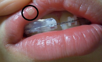 오라픽스 포스팅 사진 (4).JPG