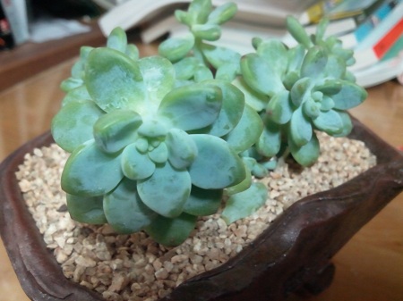 오라픽스 치아교정 포스팅(10).jpg