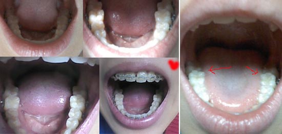 100521 kyo Q pho2.jpg