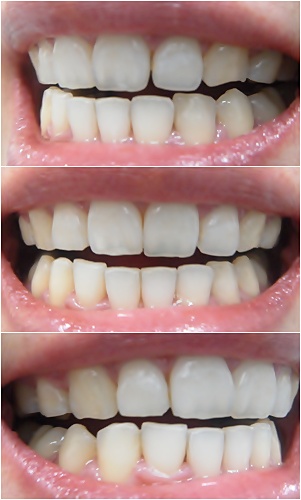 25.킬본교정 (1).jpg