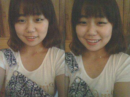 오라픽스 치아교정 포스팅 (6).jpg