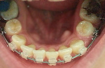 20130516_175507 copy.jpg