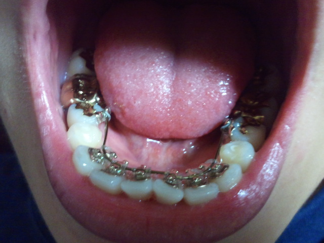 2010-10-30 18.18.48.jpg