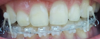 2011-11-16 09.55.18.jpg