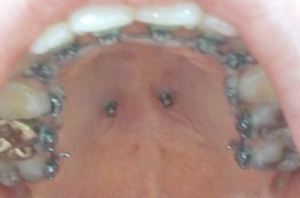 2011-11-16 13.36.57.jpg