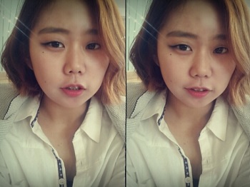 오라픽스 치아교정 포스팅(8).jpg