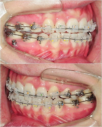 26.킬본교정 (2).jpg