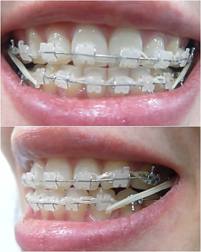 26.킬본교정 (7).jpg