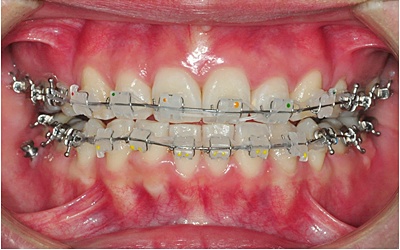 26.킬본교정 (1).jpg
