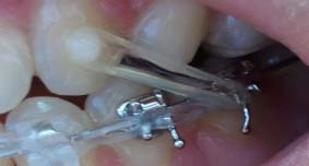 2011-10-07 08.58.54.jpg