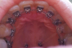 2011-10-07 13.25.20.jpg