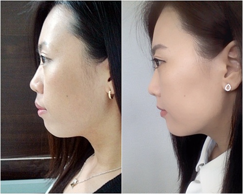 26.킬본교정 (3).jpg