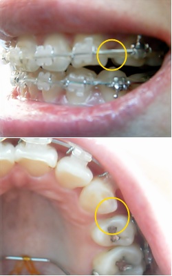 23.킬본교정 (1).jpg