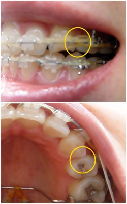 23.킬본교정 (2).jpg