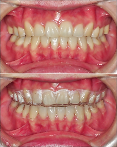 31.킬본교정 (2).jpg