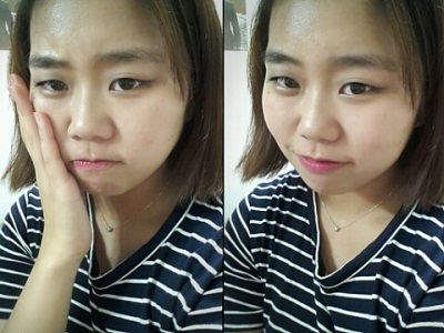 오라픽스 치아교정 포스팅 (3).jpg