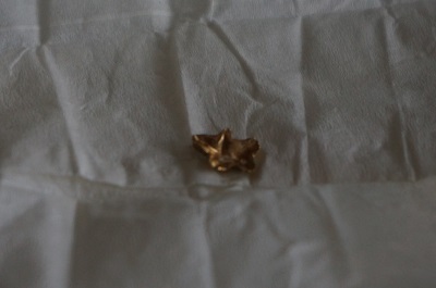 오라픽스 치아교정 포스팅(16).JPG