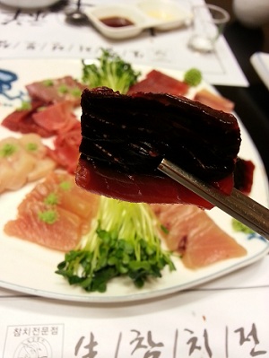 오라픽스 치아교정 포스팅(2).jpg