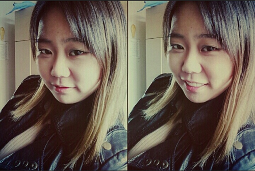 오라픽스 치아교정 포스팅(1).png