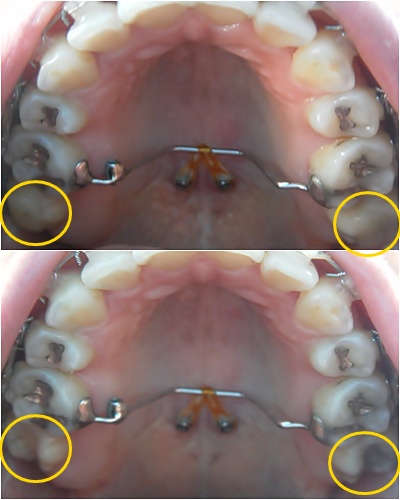 24.킬본교정 (3).jpg
