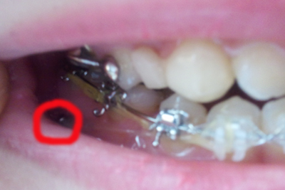 2011-03-24 14.43.28.jpg