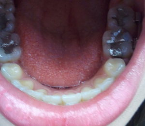 2011-03-24 15[1].25.40.jpg