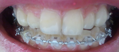 2011-03-24 14.42.28.jpg