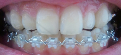 2011-03-24 14.42.17.jpg