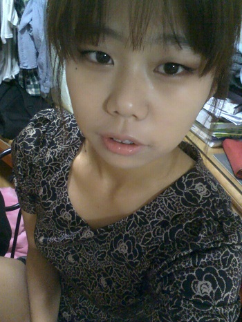 오라픽스 치아교정 포스팅(2).jpg