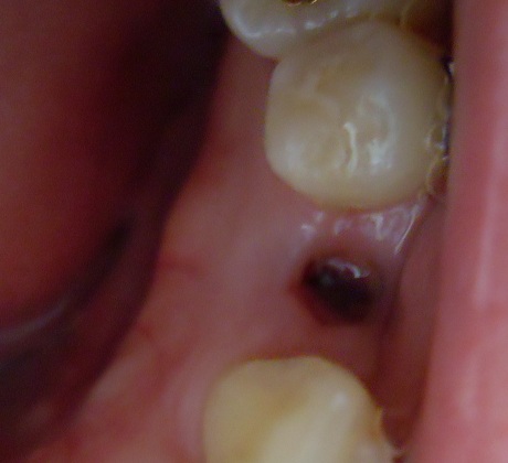 오라픽스 포스팅 사진 (6).JPG