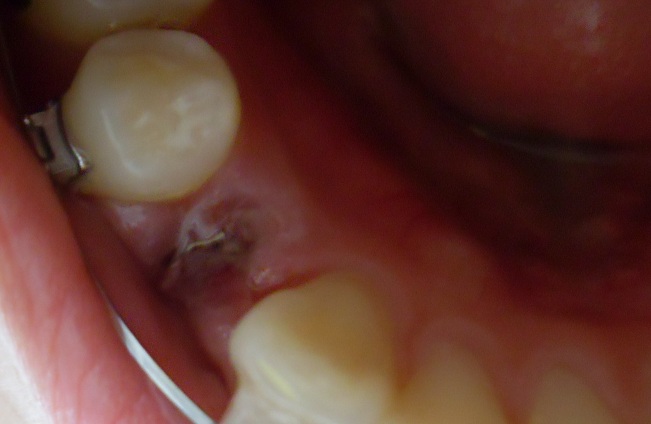 오라픽스 포스팅 사진 (5).JPG