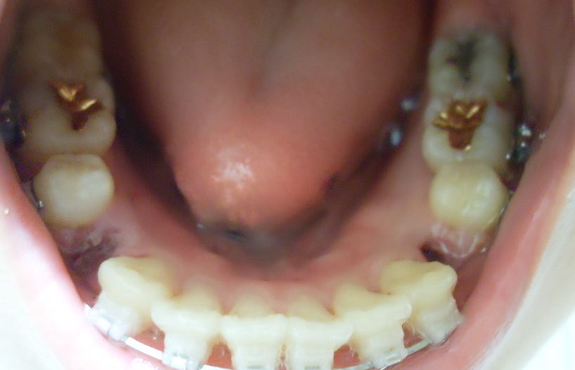 오라픽스 포스팅 사진 (4).JPG