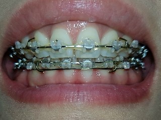 20161004_161949 (1).jpg