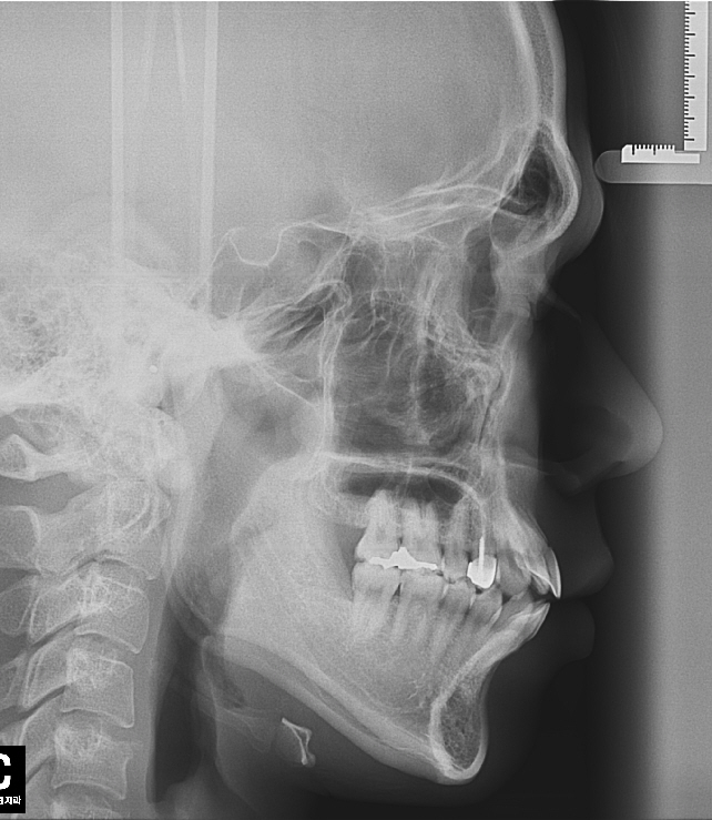 세팔로 수정.jpg